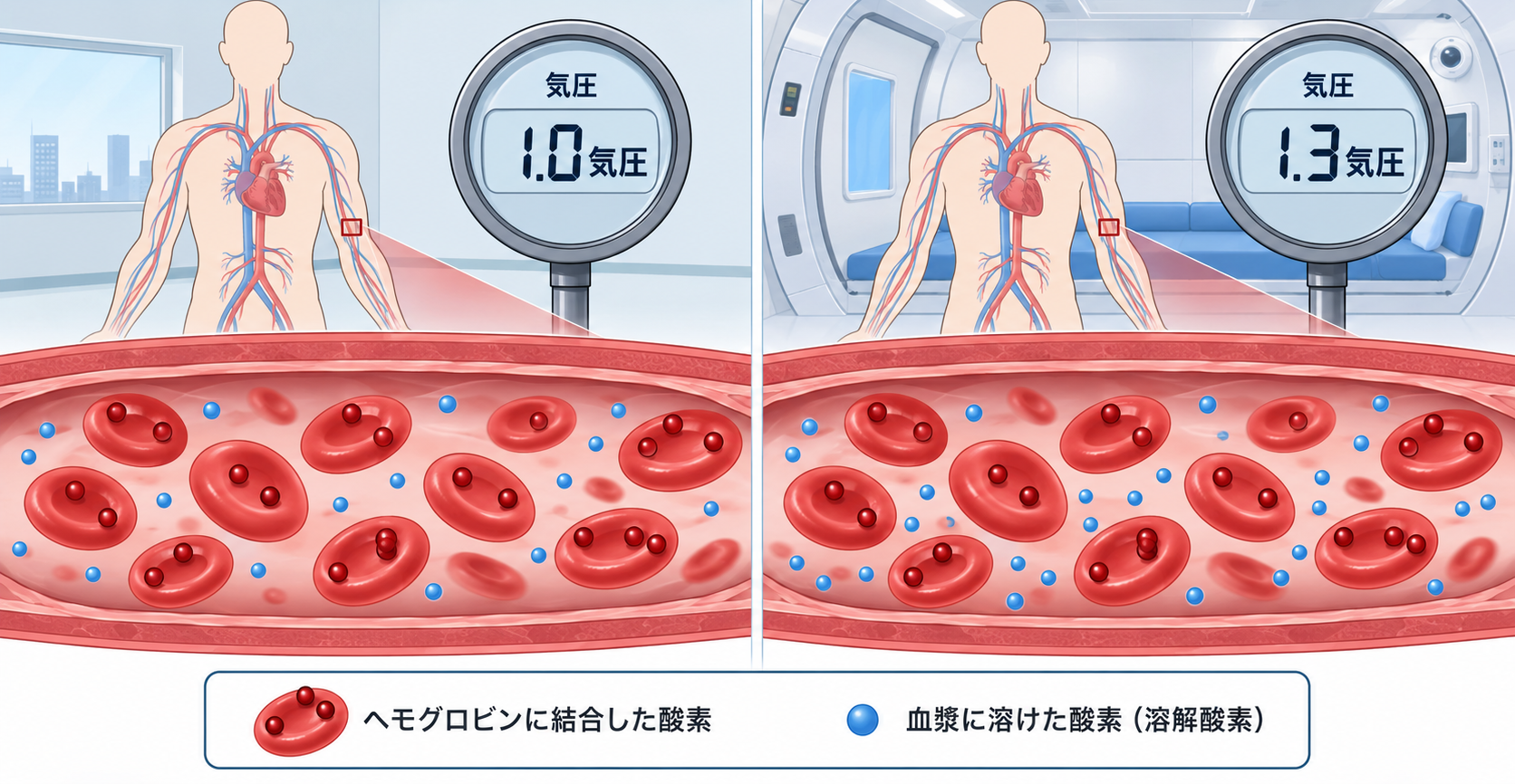 計器に1.0気圧と1.3気圧を表示し、ヘモグロビンに結合した酸素と血漿に溶けた溶解酸素を比較した概念図